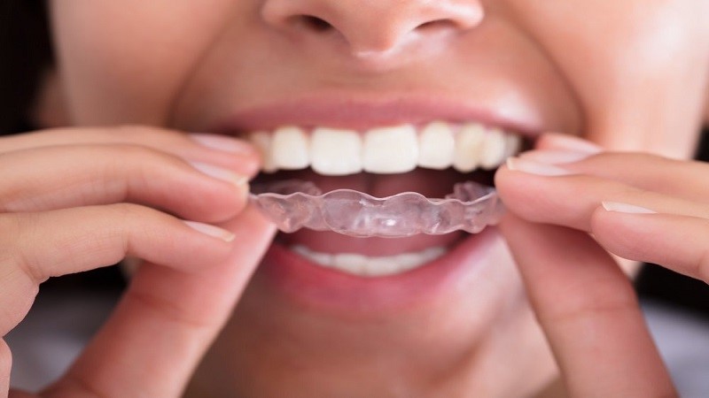 دندان قروچه چیست و چرا اتفاق می افتد؟